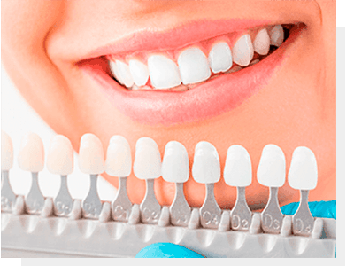 Paciente sorrindo ao comparar dentes com escala de cores